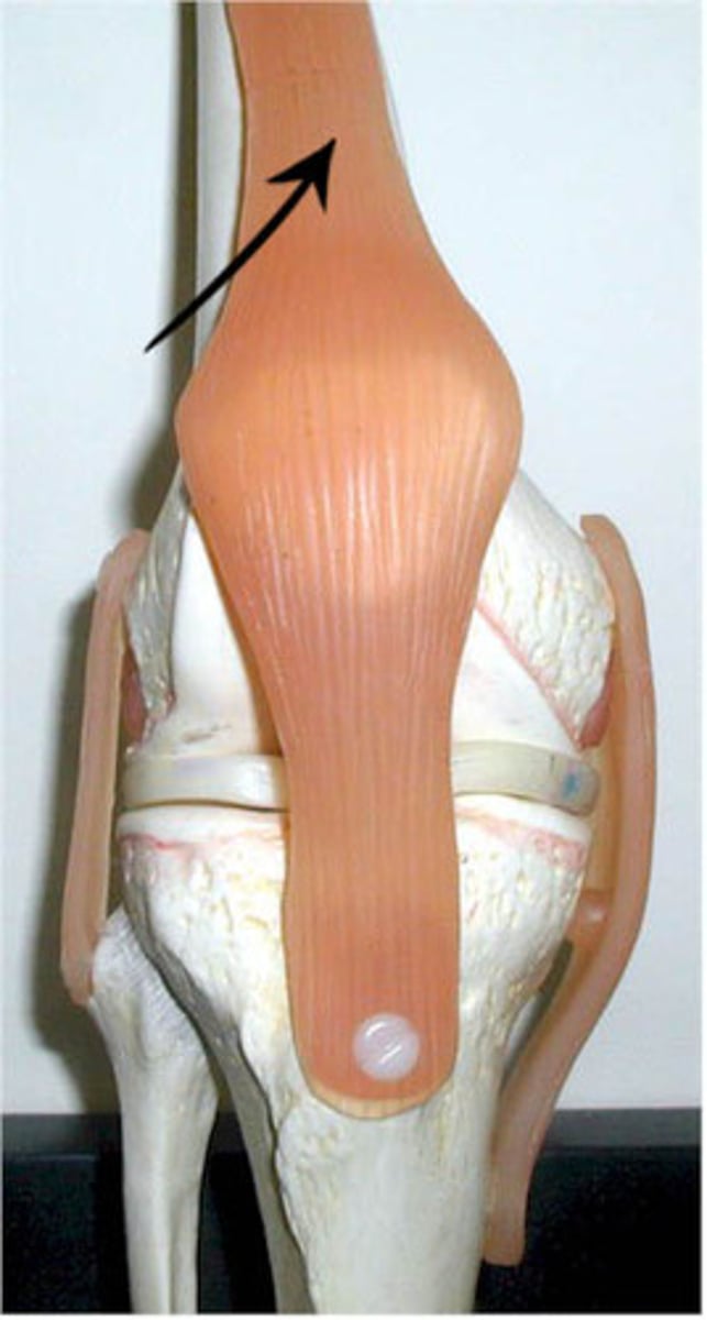 <p>common tendon for quadriceps group, attaches to patella</p>