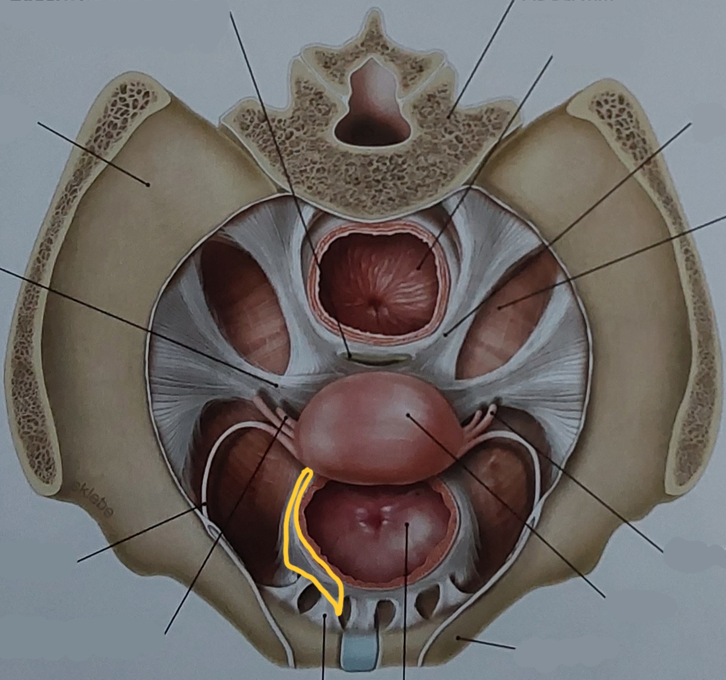 term image