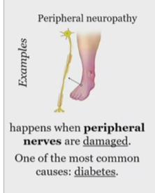 <p>when the peripheral nerves are damaged </p>