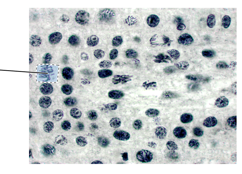 <p>What stage of mitosis is shown by the highlighted cell?</p><p>(Longitudinal section of an onion root tip).</p>