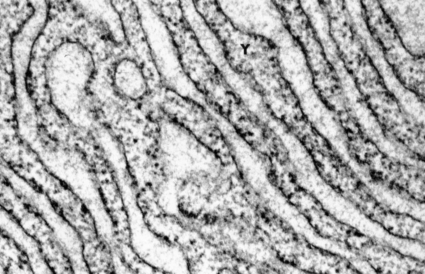 <p>has ribosomes on walls, synthesizes and distributes proteins </p>