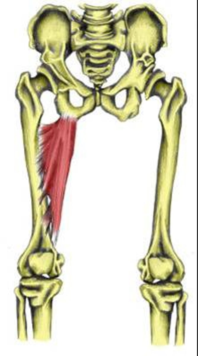 <p>inferior pubic ramus to ischial tuberosity</p>