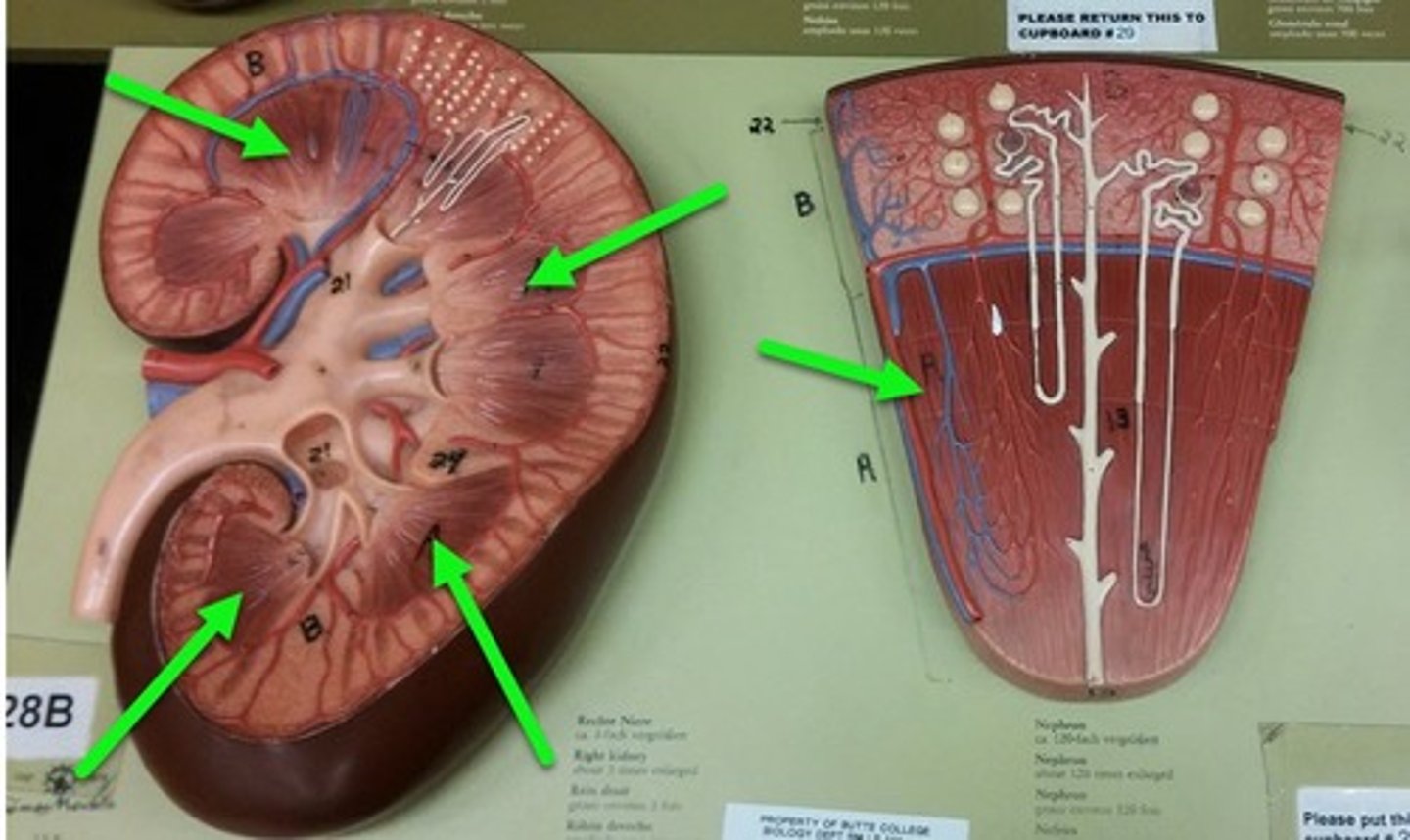 <p>region of darker tissue</p>