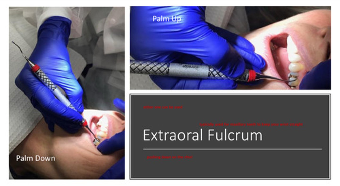 <p>1) palm up or palm down; using a pushing down motion on the chin for fulcrum</p><p>2) typically used for maxillary teeth to keep the wrist straight</p>