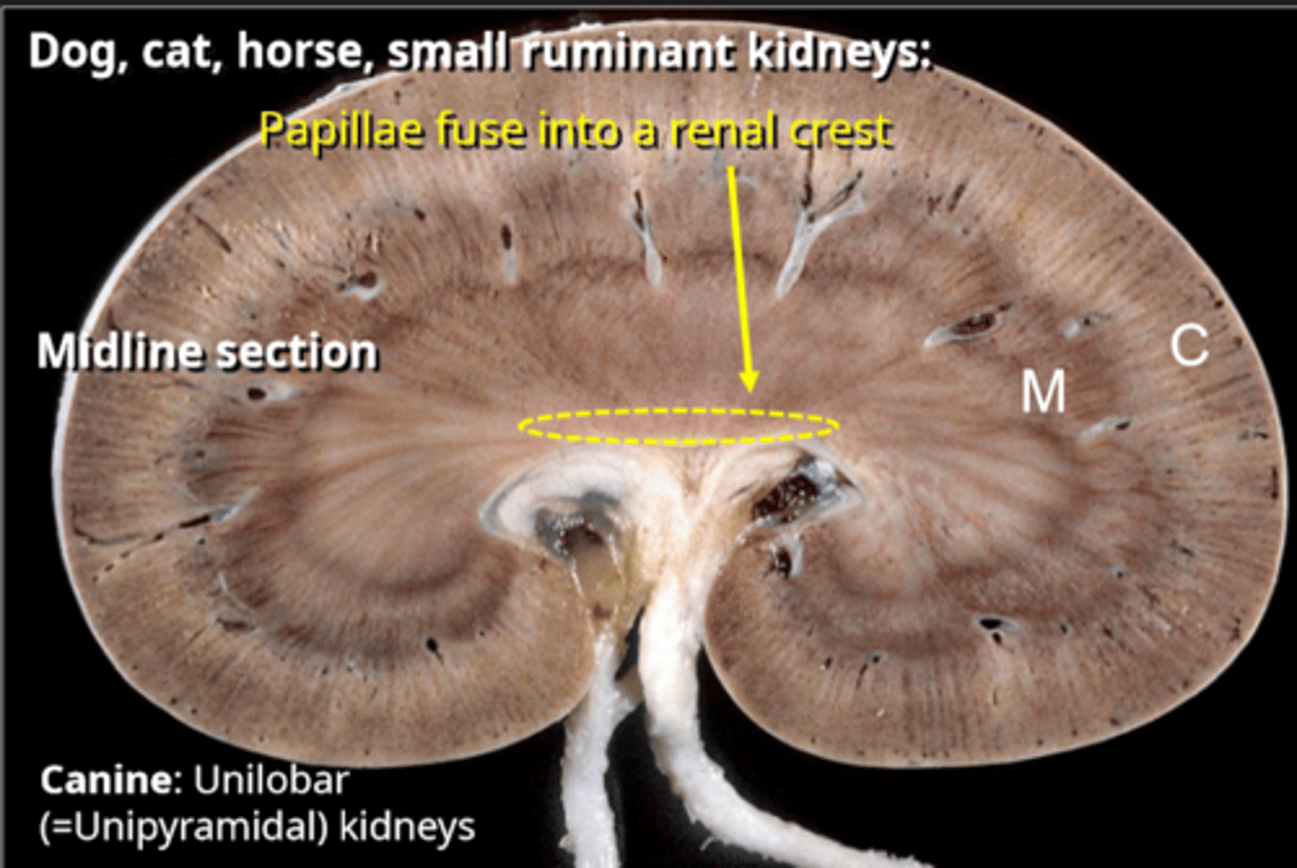 <p>unilobar (unipyramidal) kidneys</p>