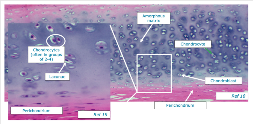 <p>Lines the articular surfaces of synovial joints, acting as a self-lubricating shock absorber with low friction properties.</p><p>articular cartilage doesn’t have a perichondrium on either surface.</p><ul><li><p>free (articular) space - exposed to synovial fluid within the joint</p></li><li><p>basal surface - in direct contact with underlying bone</p></li></ul><p>Articular cartilage is the remnant of hyaline cartilage that formed the template for the developing bone. </p><p>limited to interstitial growth because of the absence of the perichondrium</p><p>No nerves/blood vessels. </p><p></p>