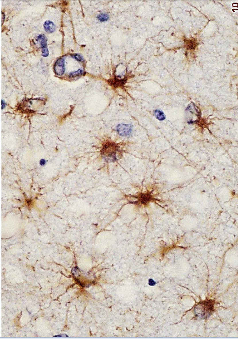 <p>role de structure et de maintien des structures</p><p>+interaction avec les neurones dont ils contrôlent l’environement et l’activité</p>
