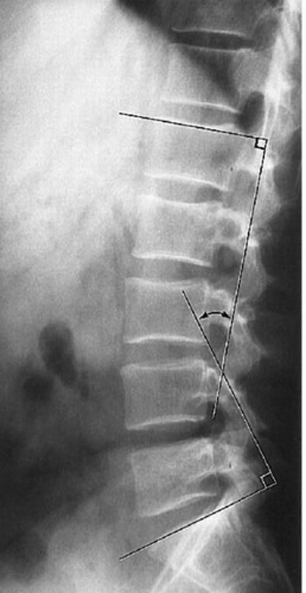 <p>What line of mensuration is this?</p>