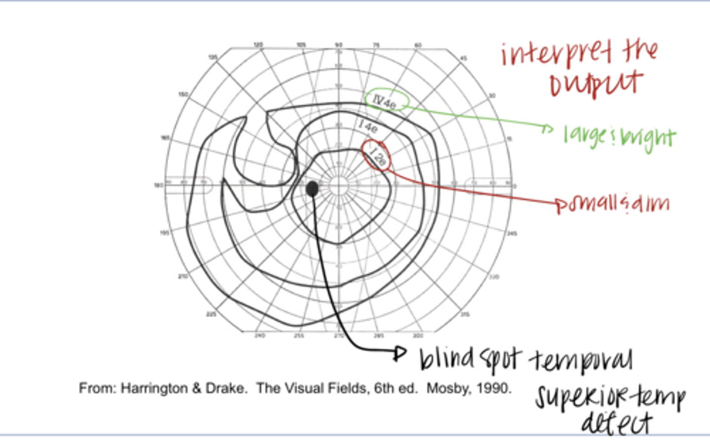 <p>A larger &amp; brighter light will most likely have a (smaller/larger) isopter around the macula</p>