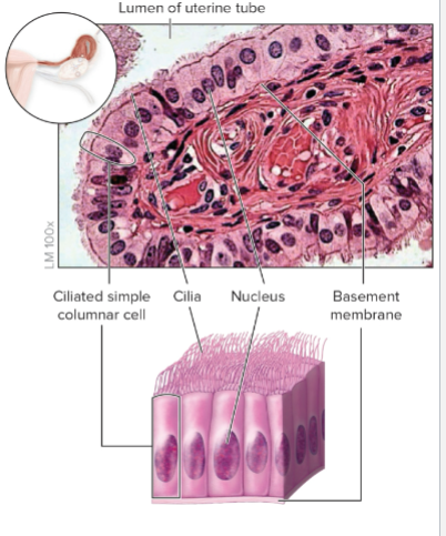 Ciliated Simple Columnar Epithelium