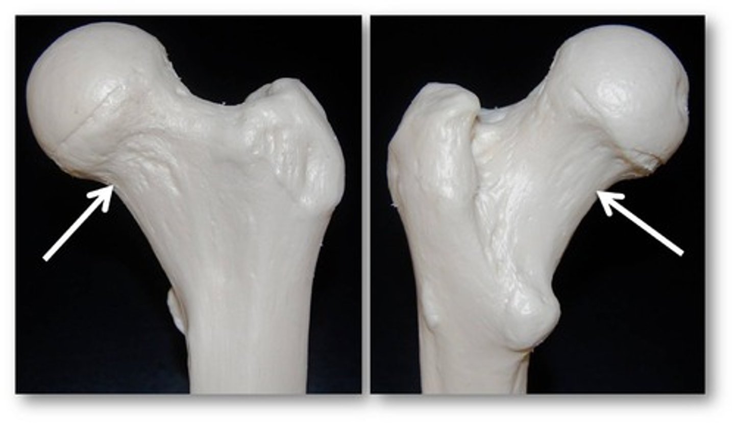 <p>Name this specific part of the femur.</p>