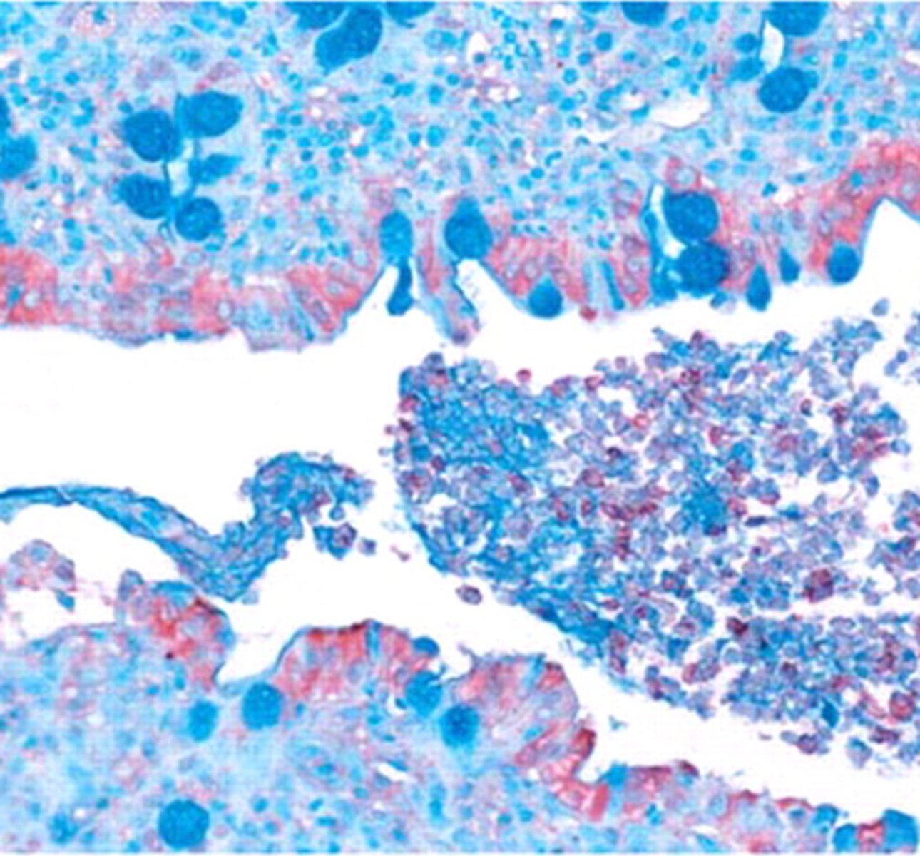 <p>The associated pathology report describes this histological section from a necropsied cat as representative of a lymphoplasmacytic/neutrophilic colitis with crypt abscess. What parasite is likely implicated in the poor health condition of the patient?</p>