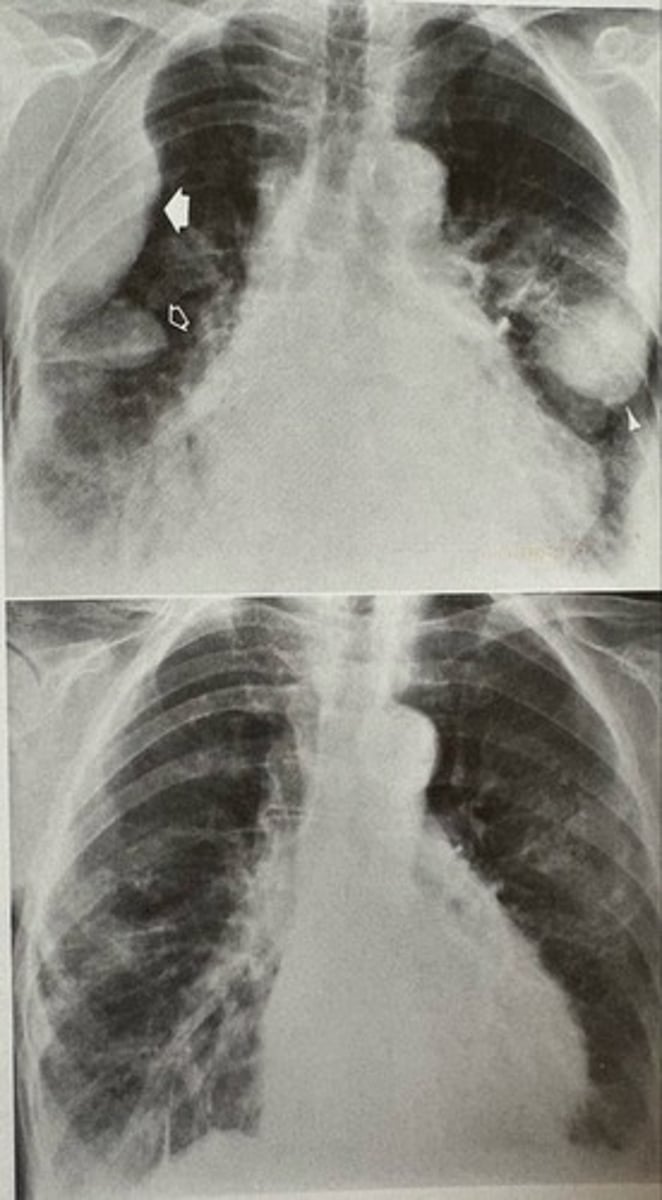 <p>what pathology is present?</p>