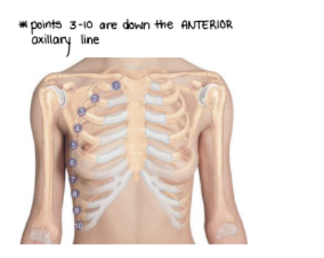 <p>Have the patient <strong>ON THEIR</strong> <strong>BACK</strong></p><ul><li><p>F STaRT</p></li></ul><p></p>