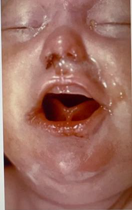 <ul><li><p>Identify the disease</p></li><li><p>Clinical feature</p></li><li><p>Histopathology</p></li><li><p>Differential diagnosis</p></li><li><p>Treatment</p></li></ul><p></p>