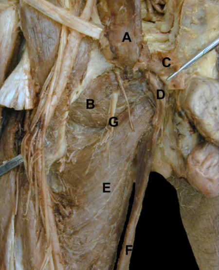<p>C</p>
