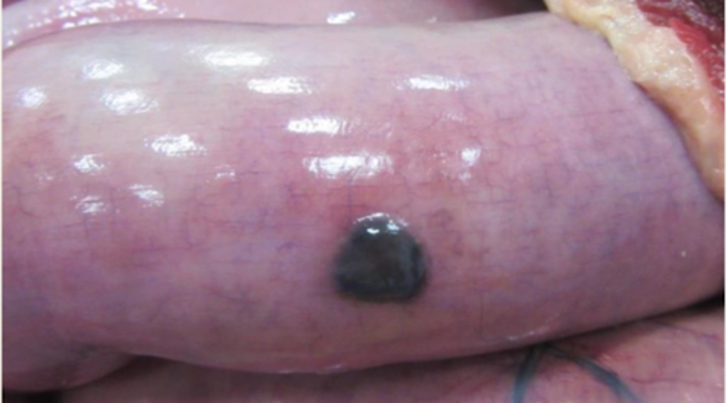 <p>¿diagnóstico morfológica y etiología?</p>