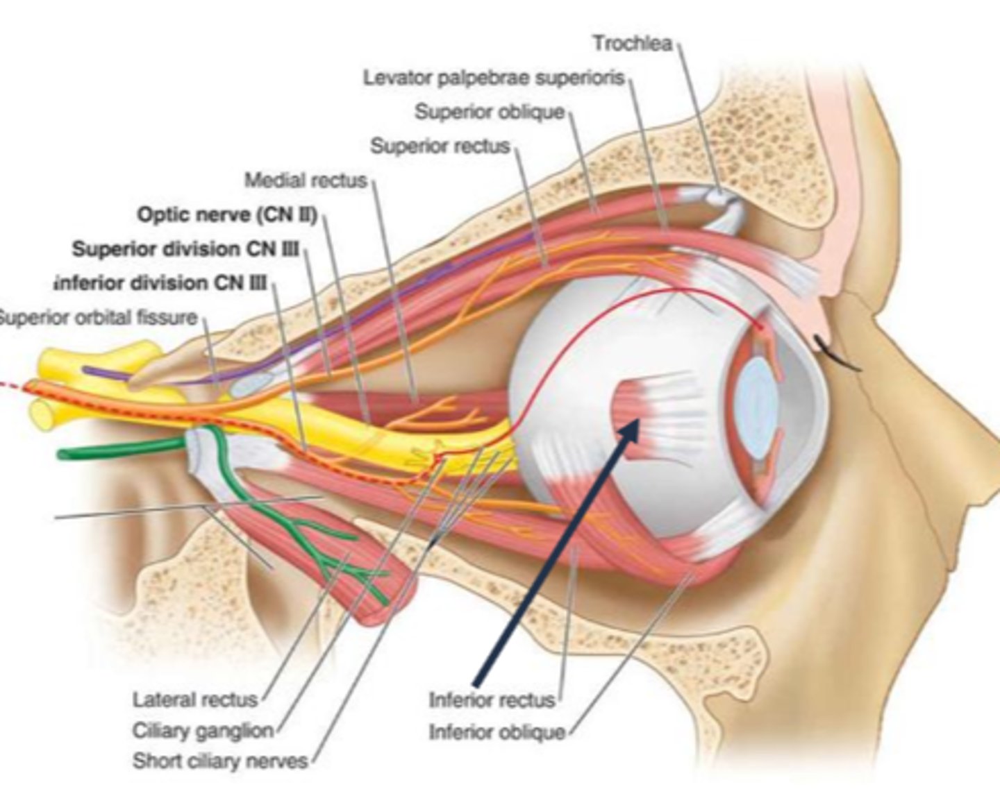 <p>ciliary ganglion damage due to trauma, infection, demyelinated, inflamed = parasymp fibers affected = pupil responds to near, but does not respond to light (light-near dissociation pupils) = large pupil</p>