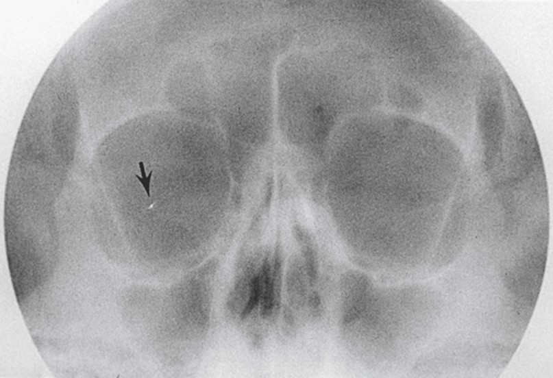 <p>xray</p>