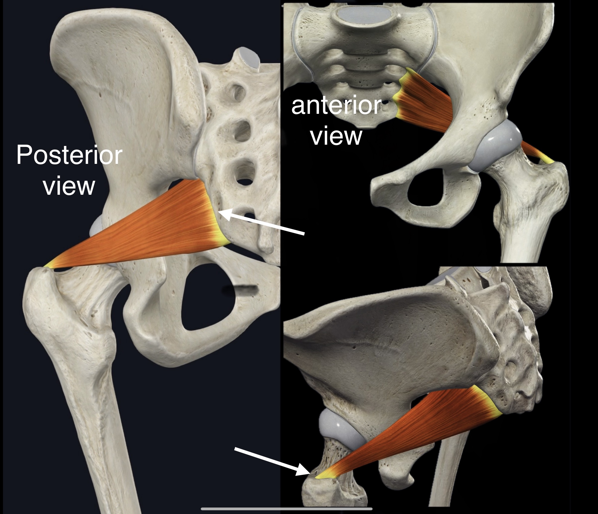 <p>Name the muscle, origin and insertion</p>