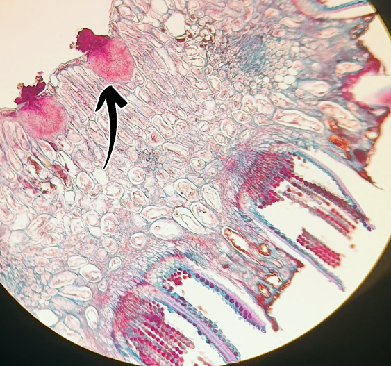 <p>Puccinia graminis: Vad indikerar pilen på för struktur?</p>