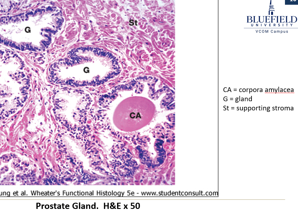 <p>What kind of <strong>epithelium </strong>lines the<strong> prostate?</strong></p>