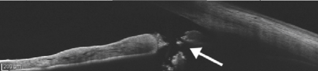 <p>OCT</p>