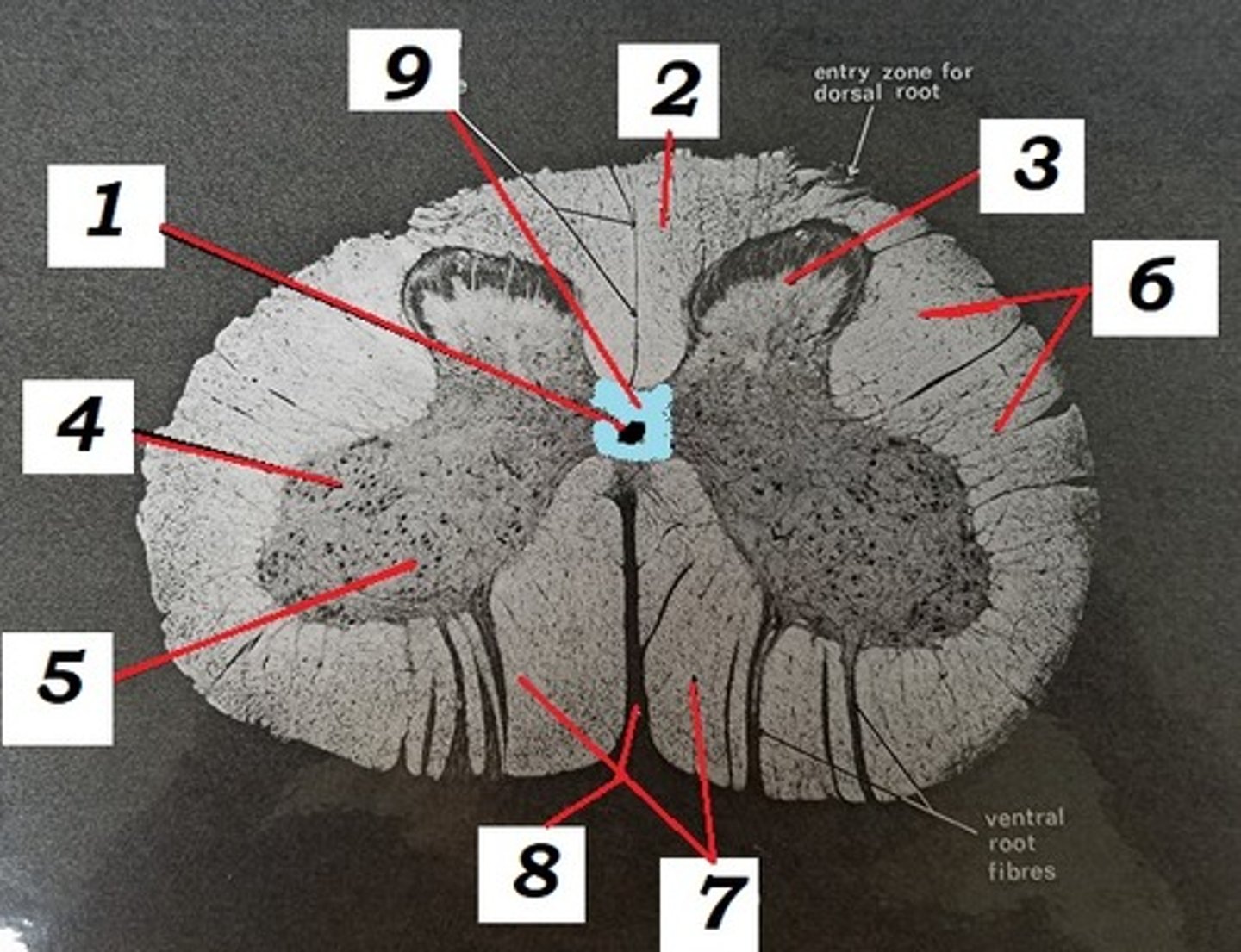 <p>name 6</p>