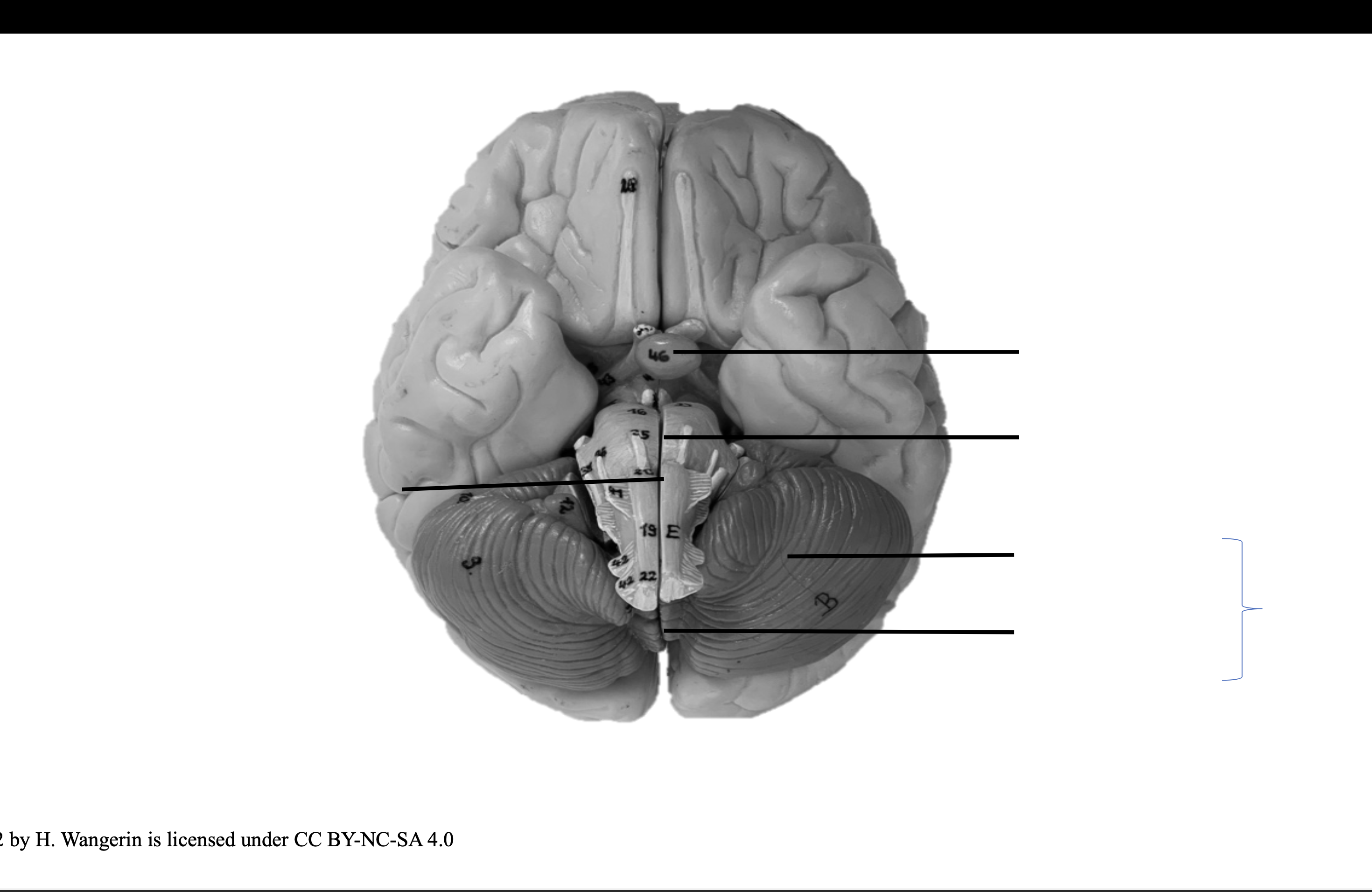 <p>Medulla oblongata</p>