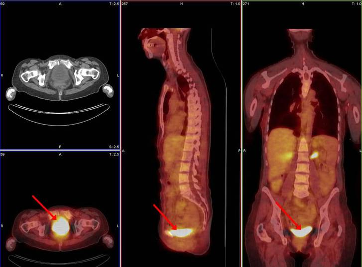 <p><span>Why is it important for the patient’s to <em>void</em> prior to scanning?</span></p>