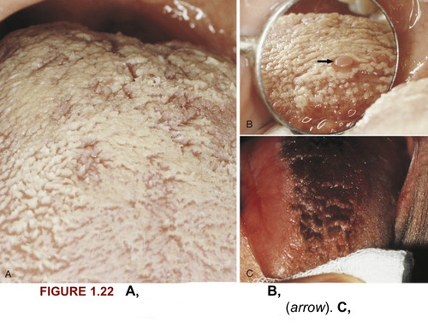 <p>Please identify what you see in Figure 1.22.</p>
