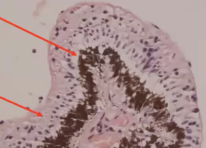 <ol><li><p>pigmented epithelium</p></li><li><p>non-pigmented epithelium</p></li></ol><p></p>