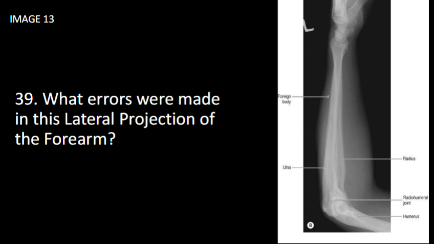 <p><span>What errors were made in this Lateral Projection of the Forearm?</span></p>