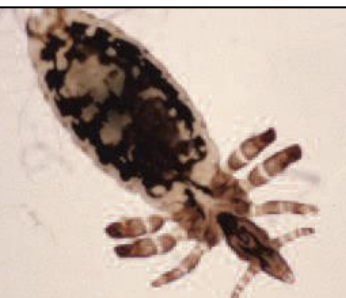 <p>Which louse is the sucking louse of horses?</p>