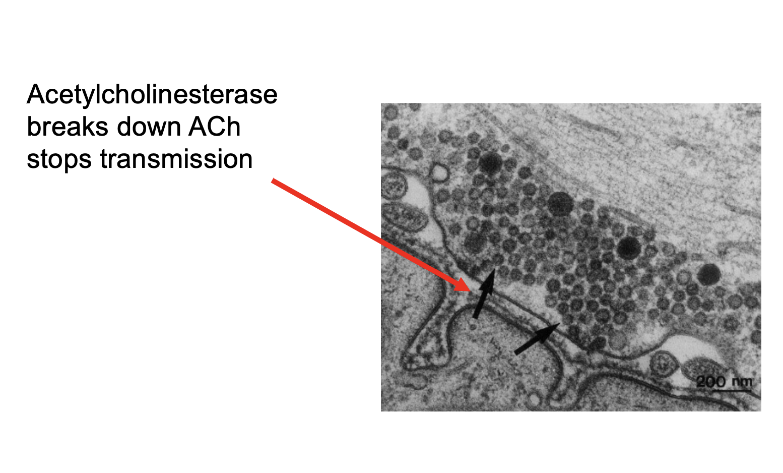 <p>Acetylcholinesterase</p>