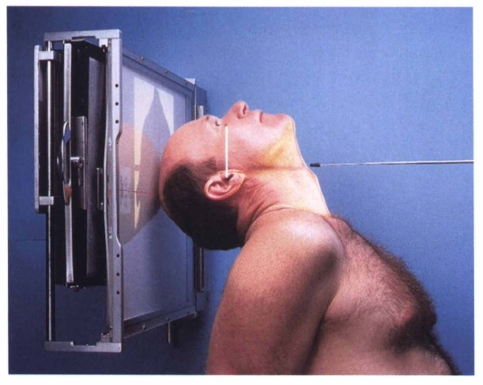 <p><span style="color: oklch(0.3039 0.04 213.68);">The submentovertical (SMV) projection requires that the _______________ line be placed as parallel as possible to the plane of the IR, and the central ray is directed ___________________ to the IOML. </span></p>