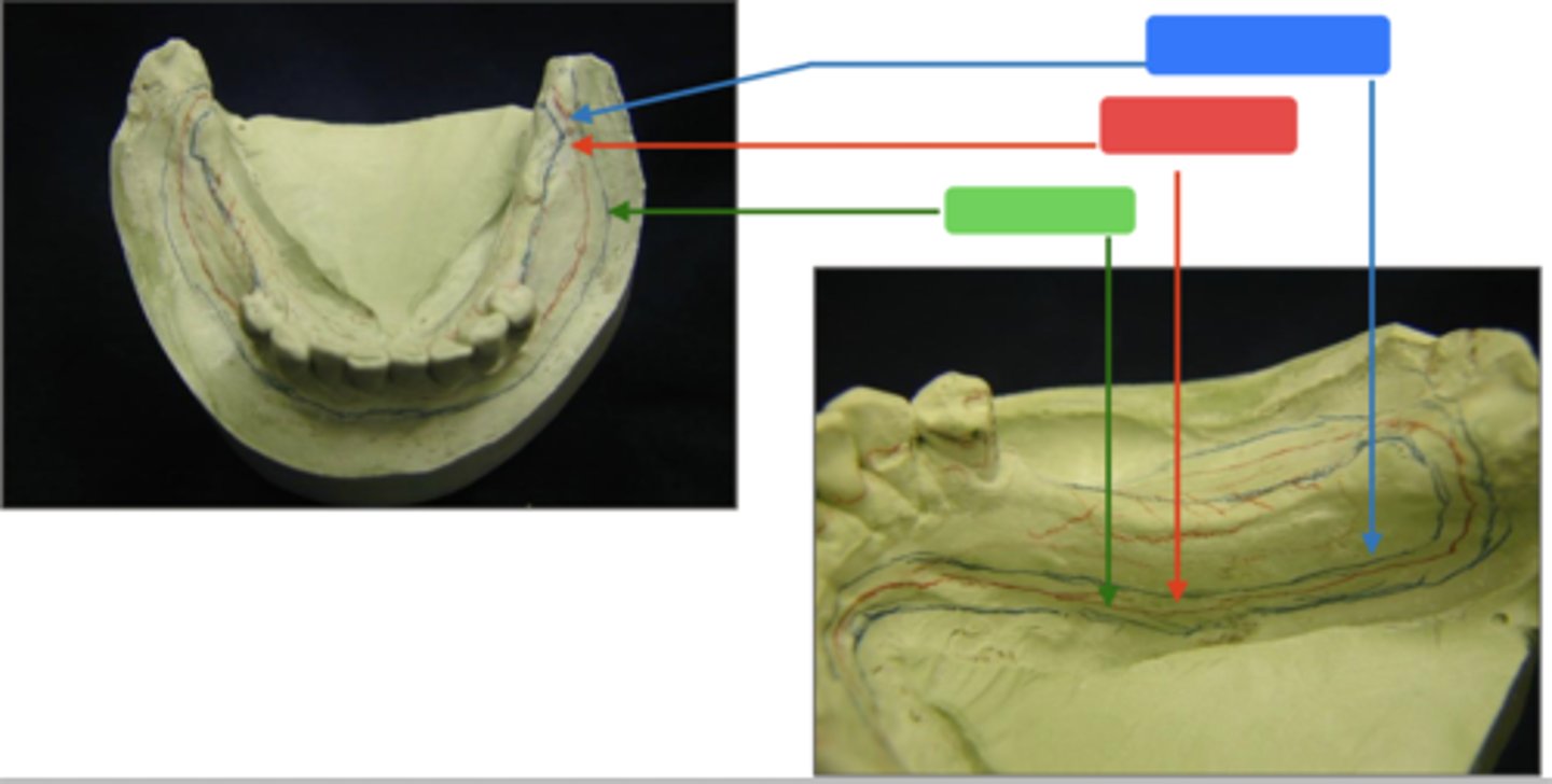 <p>ID the outline in blue:</p>