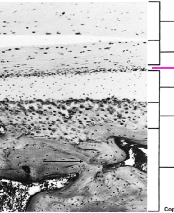 <p>Identify the histological structure of the adult mandibular condyle</p>