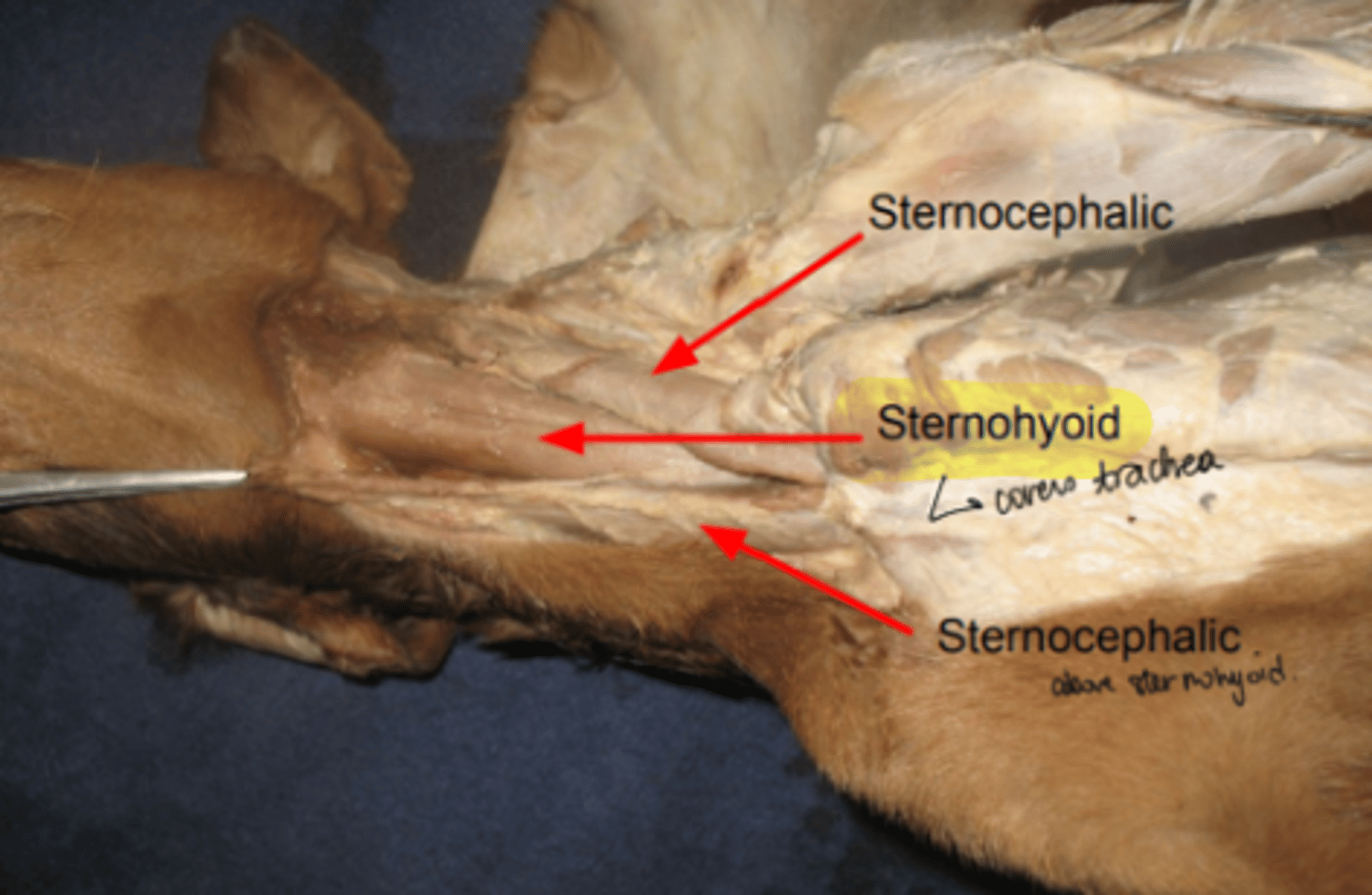 <p><span class="bgP">Innervate :</span>   hyoid bone </p><p><span class="bgP">origin : </span> sternal manubrium </p>