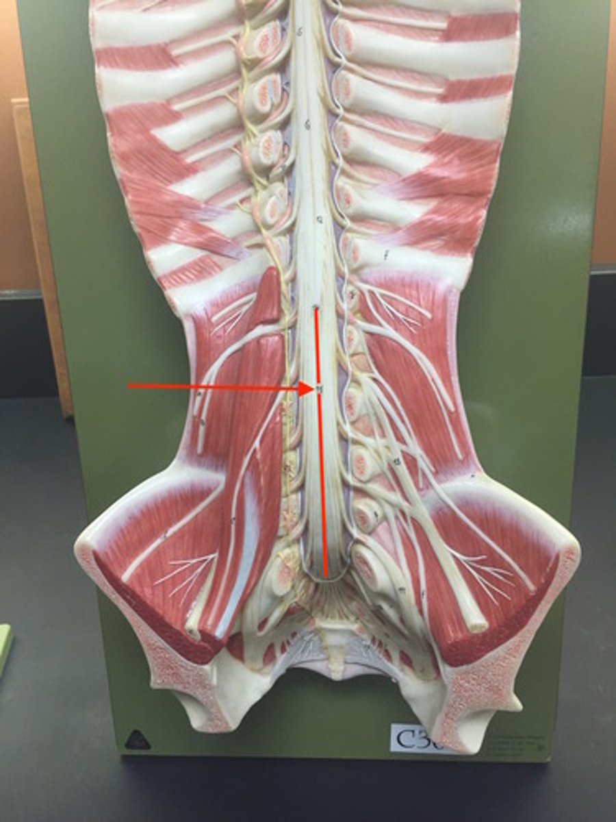 <p>anchors spinal cord to coccyx</p>