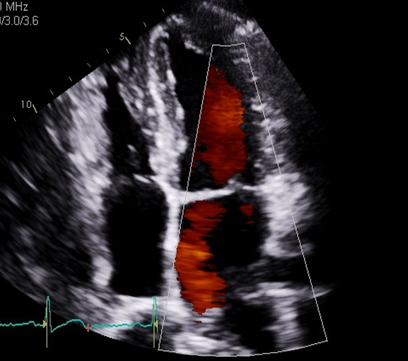 <p>Demonstrate CFI over MV to the LA and over IAS for MR</p>