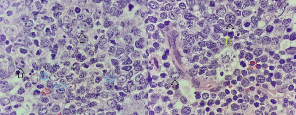 <p>Vad pekar pilarna på? </p>