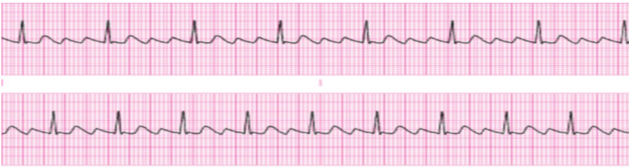<p>What’s the rhythm?</p>