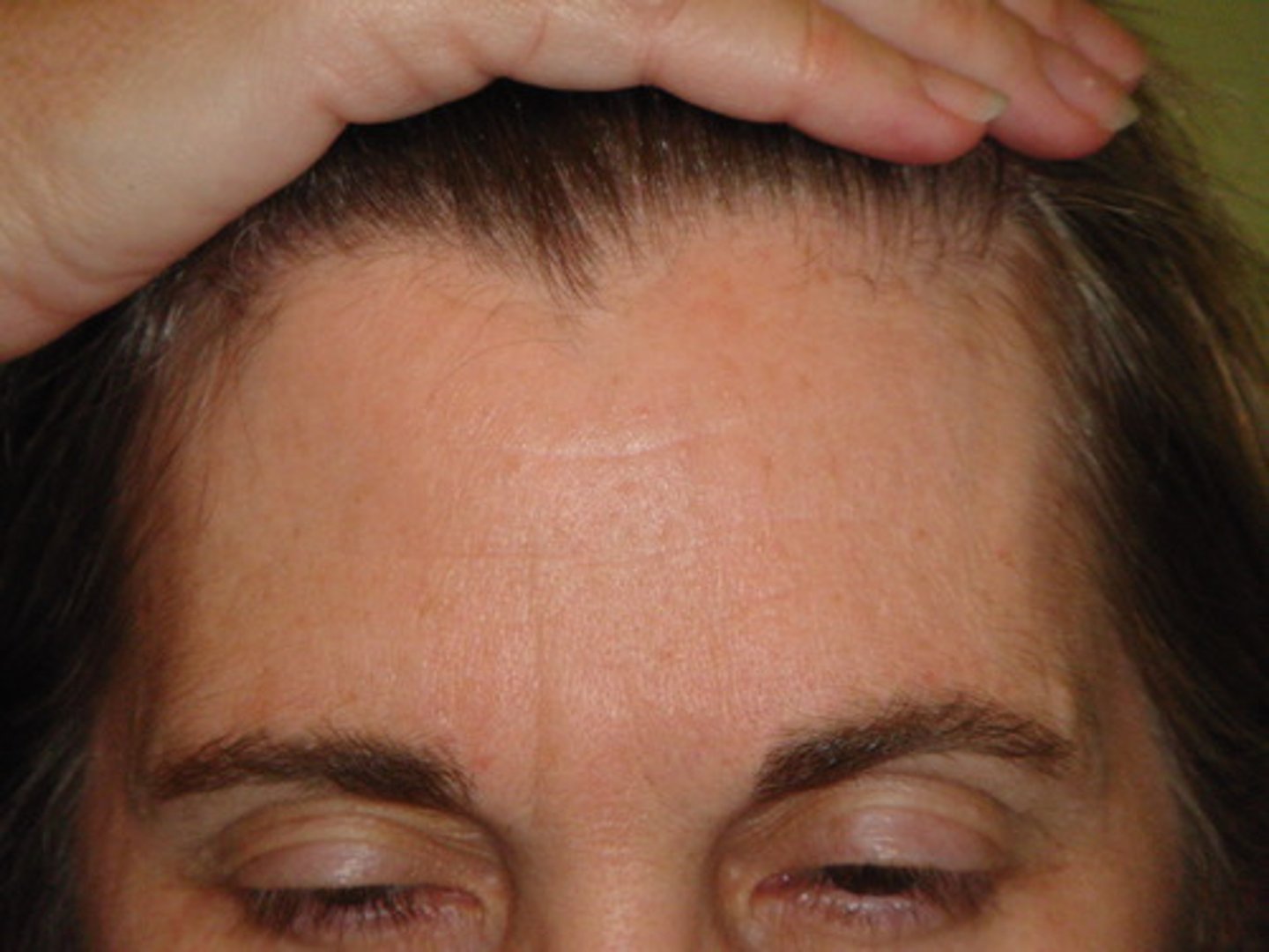 <p>forhead</p>