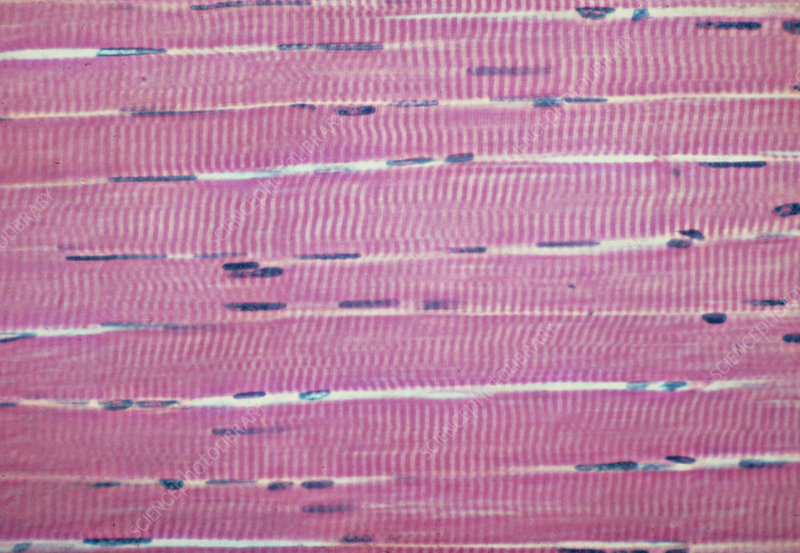 <p>Muscle tissue: skeletal</p>