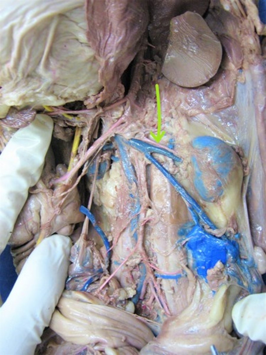 <p>identify this artery</p>