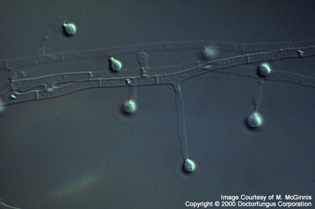 * Conidia on short conidiophores

  