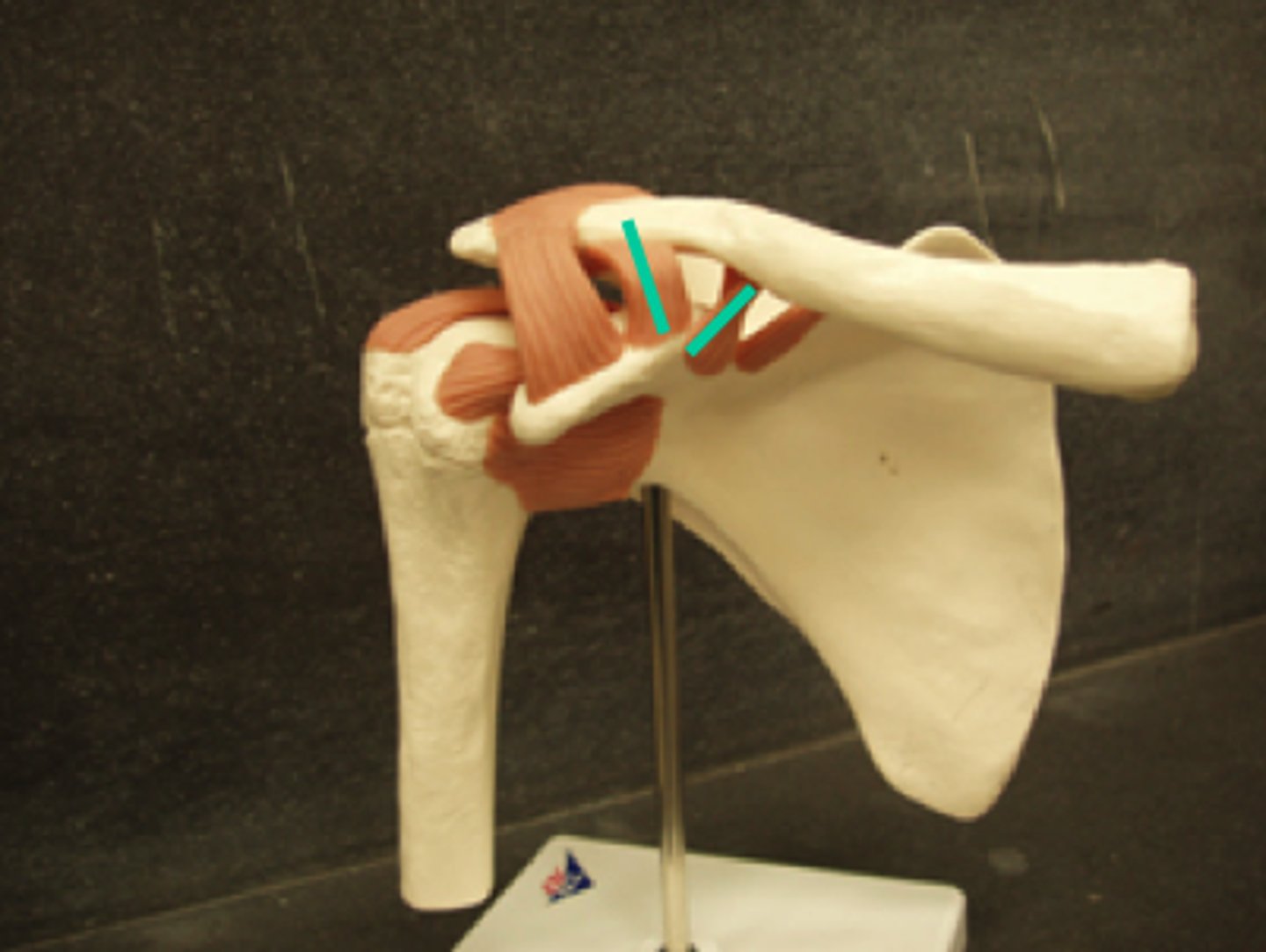 <p>connects the clavicle to the coracoid process</p>