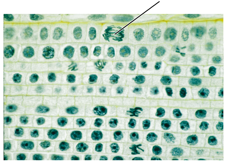 <p>What stage of mitosis is shown by this cell?</p><p>(Longitudinal section of an onion root tip).</p>