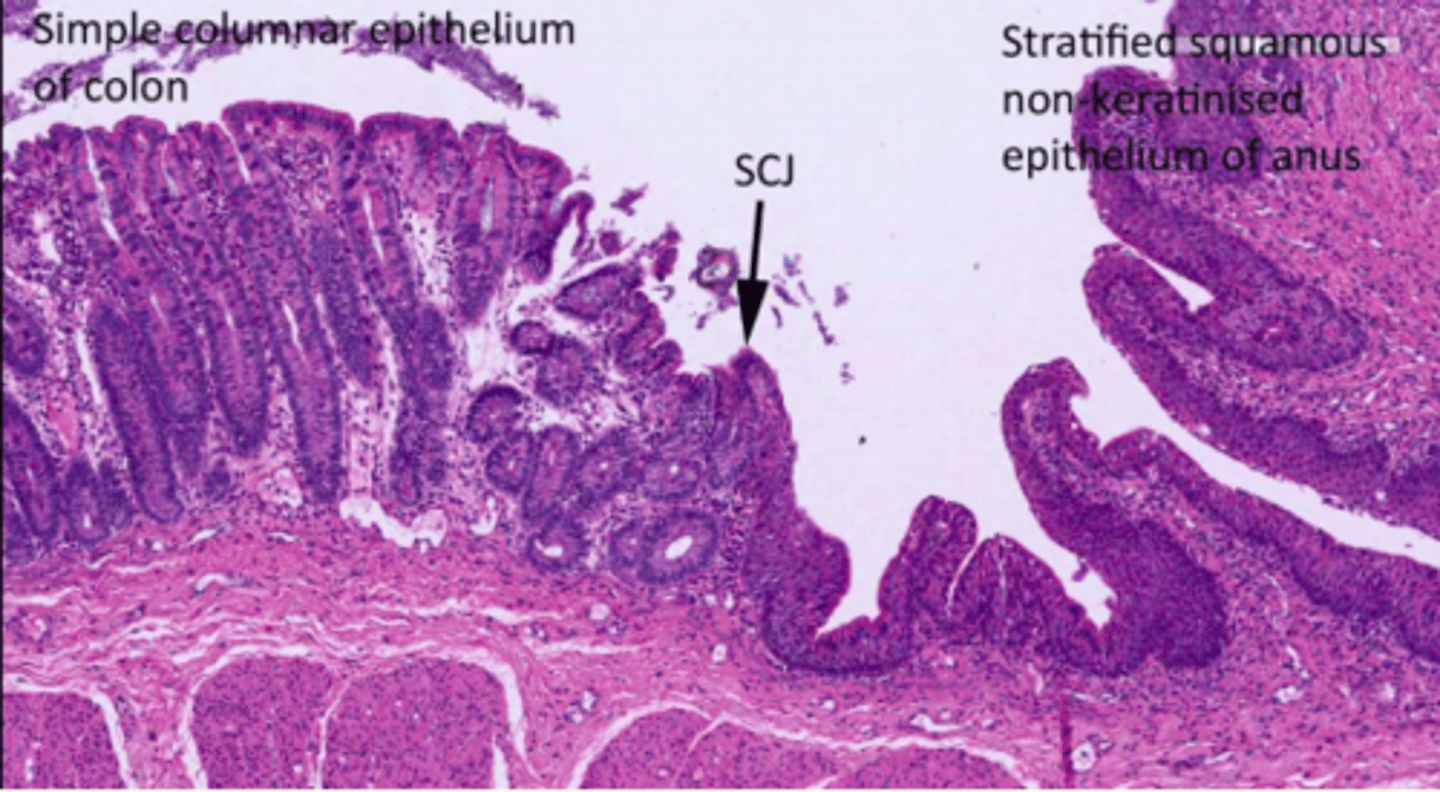 <p>Recto-anal junction or the 'squamocolumnar junction' (SCJ)</p>